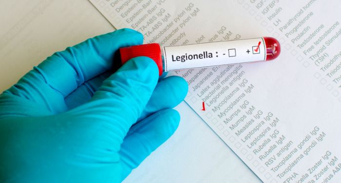 Un caso di legionella sul Verbano, casa vacanze chiusa per bonifica 