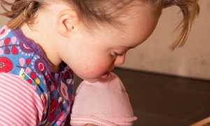 down syndrom 5956423 1280