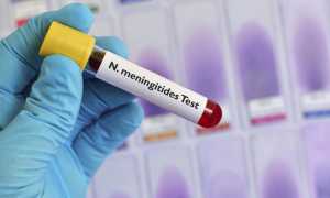 test meningite